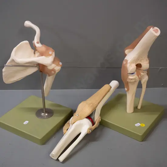 3 medical / anatomical display joints, 2 on plastic square bases marked Somso & Germany - tallest is H-340