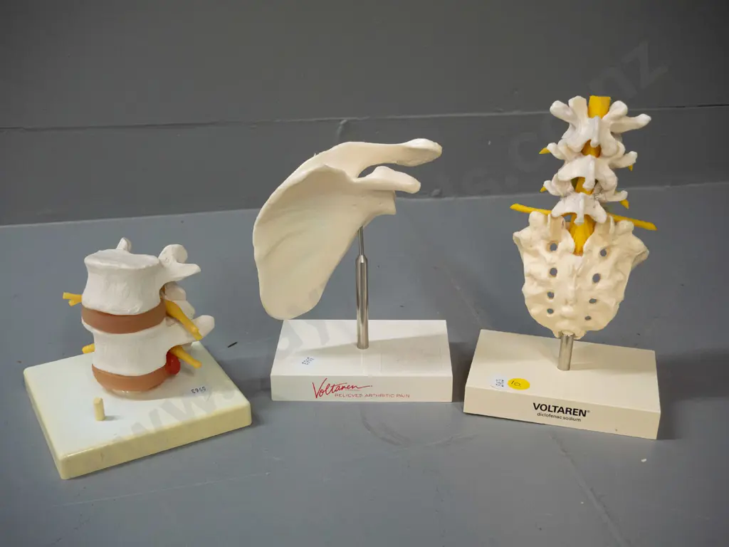 4 medical / anatomical display items, 2 marked Voltaren, 3 on plastic bases, tallest is H-170 Image 1++