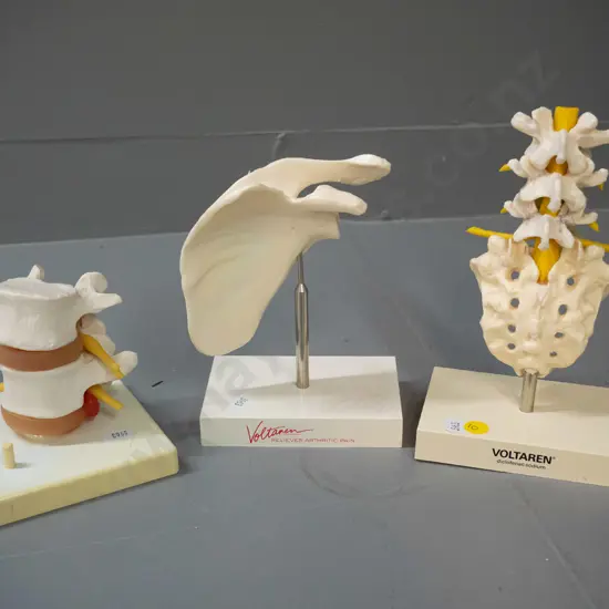 4 medical / anatomical display items, 2 marked Voltaren, 3 on plastic bases, tallest is H-170