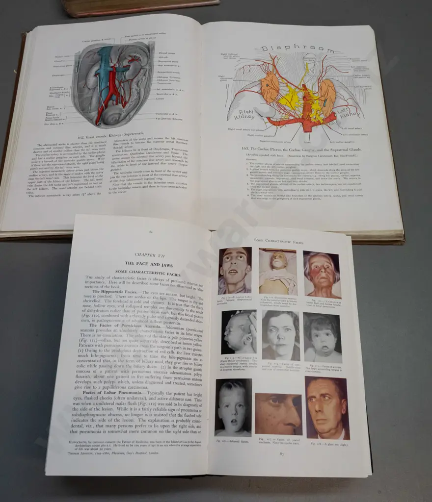 4 illustrated medical and anatomy books - one with water damage, some with wear and staining Image 1++