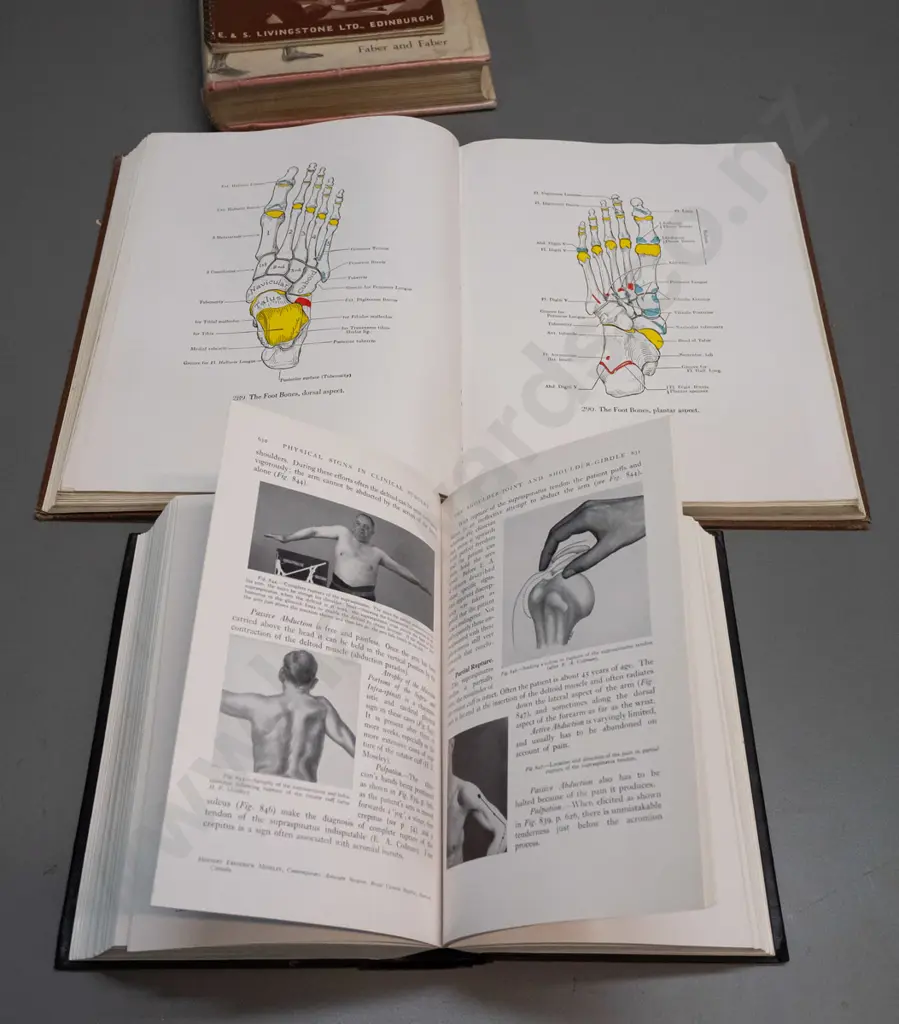 4 illustrated medical and anatomy books - one with water damage, some with wear and staining Image 1++