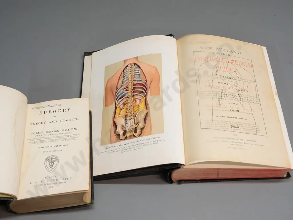 4x Medical books, NZ edition of the illustrated medical guide, Theory & Practice of Surgery, Image 1++