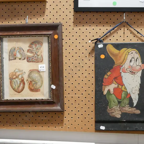 framed print on tin - Disney dwarf - rusting, framed print - human internal organs - orange dots
