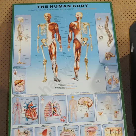 human anatomy print on board - scratches