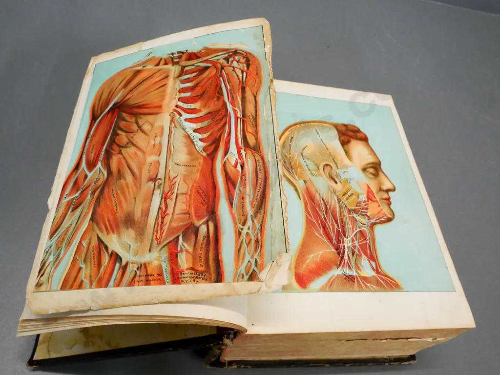 large volume 'Domestic Medical Practice' with life-flap colour anatomical illustrations etc. - loose pages, wear etc. Image 1++
