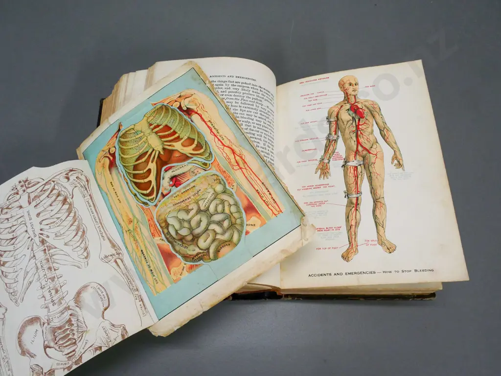 large volume 'Domestic Medical Practice' with life-flap colour anatomical illustrations etc. - loose pages, wear etc. Image 1++