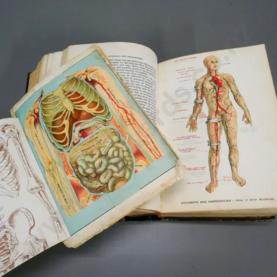 large volume 'Domestic Medical Practice' with life-flap colour anatomical illustrations etc. - loose pages, wear etc.